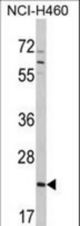 Western blot of CDC42 Antibody in NCI-H460 cell line lysates (35 ug/lane). CDC42 (arrow) was detected using the purified antibody.