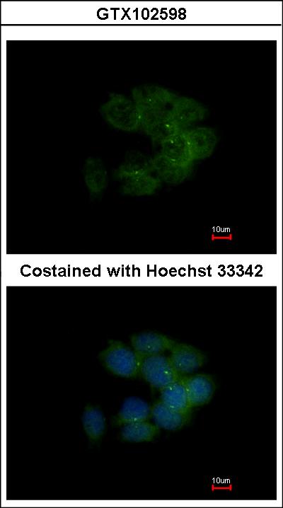 Immunofluorescence of methanol-fixed HCT116 using MRCK alpha antibody at 1:500 dilution.