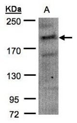 Sample (30 ug of whole cell lysate). A: H1299. 7.5% SDS PAGE. CDC42BPA antibody diluted at 1:1500