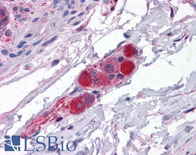 Anti-CDC42BPA / MRCK antibody IHC of human small intestine, submucosal plexus. Immunohistochemistry of formalin-fixed, paraffin-embedded tissue after heat-induced antigen retrieval. Antibody LS-B4970 concentration 3.75 ug/ml.