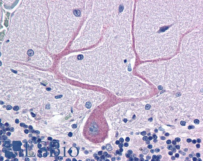 Anti-CDC42BPA / MRCK antibody IHC of human brain, cerebellum. Immunohistochemistry of formalin-fixed, paraffin-embedded tissue after heat-induced antigen retrieval. Antibody LS-B4970 concentration 3.75 ug/ml.