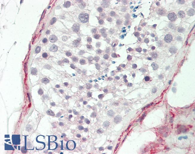 Human Testis: Formalin-Fixed, Paraffin-Embedded (FFPE)