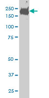 CDC42BPB monoclonal antibody (M02), clone 6G3 Western blot of CDC42BPB expression in HeLa.