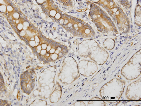 Immunoperoxidase of monoclonal antibody to CDC42BPB on formalin-fixed paraffin-embedded human small Intestine. [antibody concentration 3 ug/ml]