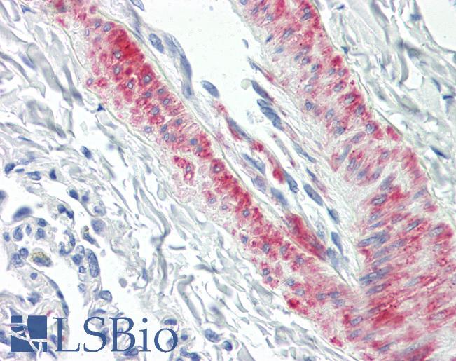 Anti-CDC42BPB antibody IHC of human lung, vessel. Immunohistochemistry of formalin-fixed, paraffin-embedded tissue after heat-induced antigen retrieval. Antibody LS-B8531 dilution 5 ug/ml.
