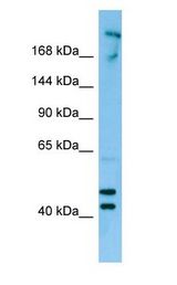 CDC42BPB / MRCKB antibody Western Blot of MCF7.
