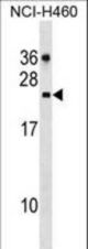 CDC42EP2 Antibody western blot of NCI-H460 cell line lysates (35 ug/lane). The CDC42EP2 antibody detected the CDC42EP2 protein (arrow).