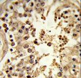 Formalin-fixed and paraffin-embedded human testis tissue reacted with CDC42EP3 Antibody , which was peroxidase-conjugated to the secondary antibody, followed by DAB staining. This data demonstrates the use of this antibody for immunohistochemistry; clinical relevance has not been evaluated.