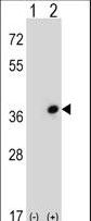 Western blot of CDC42EP3 (arrow) using rabbit polyclonal CDC42EP3 Antibody. 293 cell lysates (2 ug/lane) either nontransfected (Lane 1) or transiently transfected (Lane 2) with the CDC42EP3 gene.