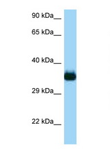 CDC42EP4 antibody LS-C146351 Western blot of Rat Liver lysate. Antibody concentration 1 ug/ml.