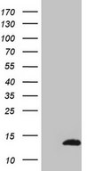 HEK293T cells were transfected with the pCMV6-ENTRY control (Left lane) or pCMV6-ENTRY CDC42SE2 (Right lane) cDNA for 48 hrs and lysed. Equivalent amounts of cell lysates (5 ug per lane) were separated by SDS-PAGE and immunoblotted with anti-CDC42SE2 (1:2000).