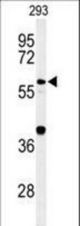 Western blot of CDC45L Antibody in 293 cell line lysates (35 ug/lane). CDC45L (arrow) was detected using the purified antibody.