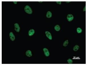 Immunofluorescent staining using CDC5L antibody. Immunostaining analysis in HeLa cells. HeLa cells were fixed with 4% paraformaldehyde and permeabilized with 0.01% Triton-X100 in PBS. The cells were immunostained with anti-CDC5L antibody.