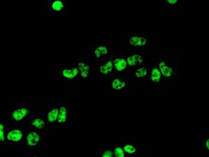 Immunofluorescent staining of HepG2 cells using anti-CDC5L antibody.