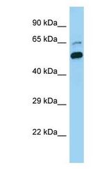 CDC73 / Parafibromin antibody Western Blot of Human HeLa Cell. Antibody dilution: 1 ug/ml.