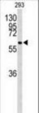 Western blot of CDC73 Antibody in 293 cell line lysates (35 ug/lane). CDC73 (arrow) was detected using the purified antibody.