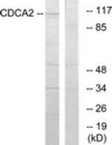 Western blot of extracts from 293 cells, using CDCA2 Antibody. The lane on the right is treated with the synthesized peptide.
