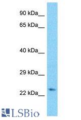 CDCA3 antibody Western Blot of HCT15. Antibody dilution: 1 ug/ml.