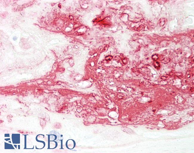 Anti-CDCA3 antibody IHC of human placenta. Immunohistochemistry of formalin-fixed, paraffin-embedded tissue after heat-induced antigen retrieval. Antibody LS-B8534 dilution 5 ug/ml.