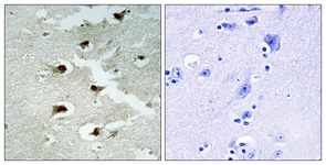 IHC of paraffin-embedded human brain tissue, using CDCA4 Antibody. The picture on the right is treated with the synthesized peptide.