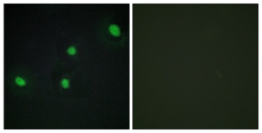 Immunofluorescence of HepG2 cells, using CDCA4 Antibody. The picture on the right is treated with the synthesized peptide.