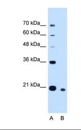 Lane A: Marker. Lane B: HepG2 cell lysate. Antibody concentration: 2.5 ug/ml. Gel concentration: 12%.