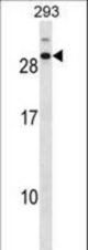CDCA4 Antibody western blot of 293 cell line lysates (35 ug/lane). The CDCA4 antibody detected the CDCA4 protein (arrow).