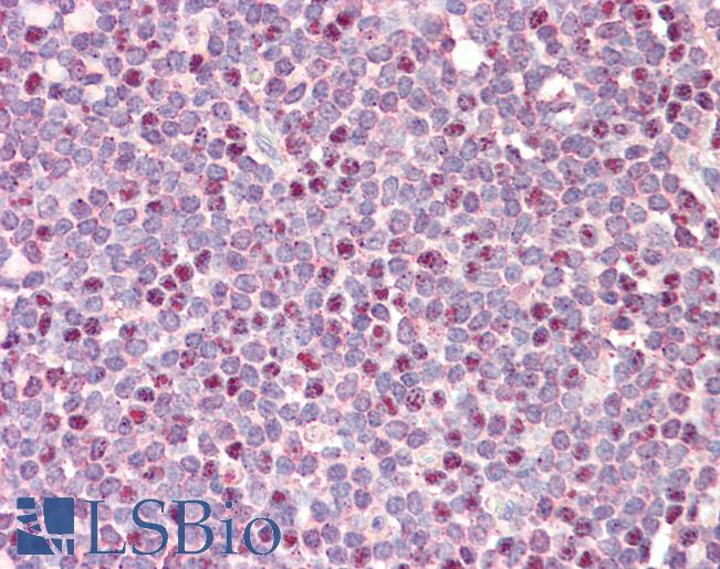 Anti-CDCA5 / Sororin antibody IHC staining of human tonsil. Immunohistochemistry of formalin-fixed, paraffin-embedded tissue after heat-induced antigen retrieval. Antibody LS-B9756 concentration 10 ug/ml.
