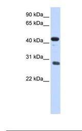 Placenta lysate. Antibody concentration: 1.0 ug/ml. Gel concentration: 12%.