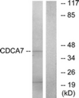 Western blot of extracts from K562 cells, using CDCA7 Antibody. The lane on the right is treated with the synthesized peptide.