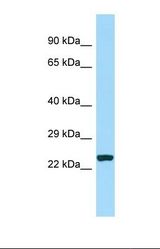 Western blot of Human MCF7. CDCA7 antibody dilution 1.0 ug/ml.