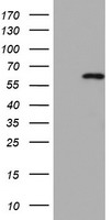 HEK293T cells were transfected with the pCMV6-ENTRY control (Left lane) or pCMV6-ENTRY CDCA7L (Right lane) cDNA for 48 hrs and lysed. Equivalent amounts of cell lysates (5 ug per lane) were separated by SDS-PAGE and immunoblotted with anti-CDCA7L.