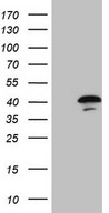 HEK293T cells were transfected with the pCMV6-ENTRY control (Left lane) or pCMV6-ENTRY CDCA8 (Right lane) cDNA for 48 hrs and lysed. Equivalent amounts of cell lysates (5 ug per lane) were separated by SDS-PAGE and immunoblotted with anti-CDCA8 (1:2000).
