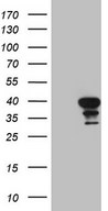 HEK293T cells were transfected with the pCMV6-ENTRY control (Left lane) or pCMV6-ENTRY CDCA8 (Right lane) cDNA for 48 hrs and lysed. Equivalent amounts of cell lysates (5 ug per lane) were separated by SDS-PAGE and immunoblotted with anti-CDCA8 (1:2000).