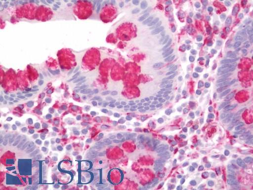 Human Colon: Formalin-Fixed, Paraffin-Embedded (FFPE)