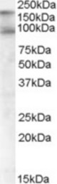 CDCP1 antibody (1 ug/ml) staining of Human Colon lysate (35 ug protein/ml in RIPA buffer). Primary incubation was 1 hour. Detected by chemiluminescence.