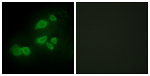 Immunofluorescence of HepG2 cells, using CDCP1 Antibody. The picture on the right is treated with the synthesized peptide.