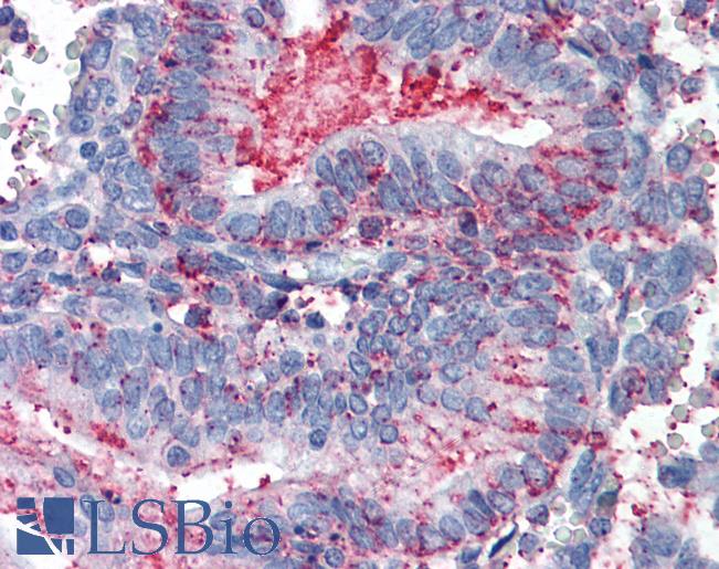 Anti-CDCP1 antibody LS-A8447 IHC of human uterus. Immunohistochemistry of formalin-fixed, paraffin-embedded tissue after heat-induced antigen retrieval.