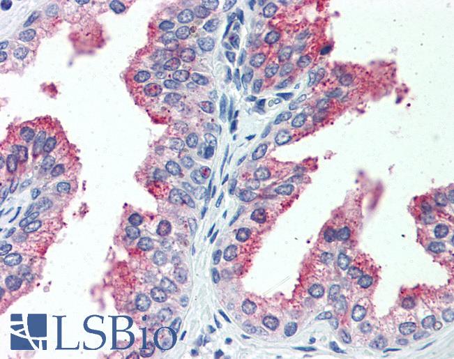Anti-CDCP1 antibody LS-A8447 IHC of human prostate. Immunohistochemistry of formalin-fixed, paraffin-embedded tissue after heat-induced antigen retrieval.