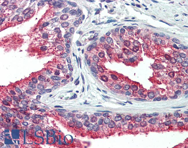 Human, Prostate: Formalin-Fixed Paraffin-Embedded (FFPE)