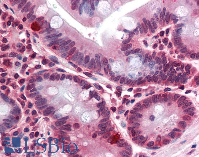 Anti-CDCP1 antibody LS-A8450 IHC of human small intestine. Immunohistochemistry of formalin-fixed, paraffin-embedded tissue after heat-induced antigen retrieval.