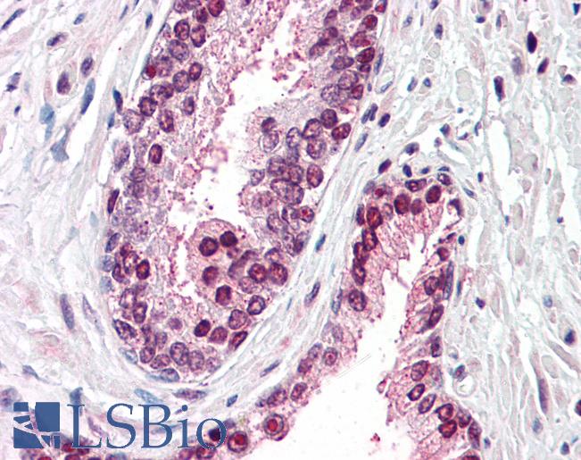 Anti-CDCP1 antibody LS-A8450 IHC of human prostate. Immunohistochemistry of formalin-fixed, paraffin-embedded tissue after heat-induced antigen retrieval.