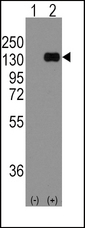 Western blot of CDH1 (arrow) using rabbit polyclonal CDH1 Antibody. 293 cell lysates (2 ug/lane) either nontransfected (Lane 1) or transiently transfected with the CDH1 gene (Lane 2) (Origene Technologies).