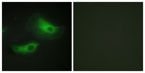 Immunofluorescence of HeLa cells, using ADD2 Antibody. The picture on the right is treated with the synthesized peptide.