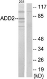 Western blot of extracts from 293 cells, using ADD2 Antibody. The lane on the right is treated with the synthesized peptide.