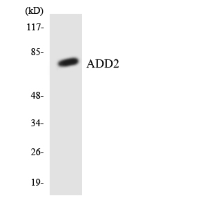 Western blot of the lysates from HeLa cells using ADD2 antibody.