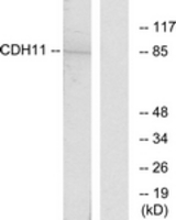 Western blot of extracts from Jurkat cells, using CDH11 Antibody. The lane on the right is treated with the synthesized peptide.