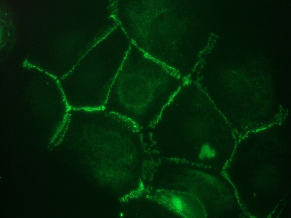 Immunocytochemistry on Cadherin 11 transfected PC3 cells