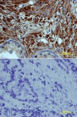 Cadherin-1 1 in Human Prostate. Cadherin-11 was detected in immersion fixed paraffin-embedded sections of human prostate array using Human Cadherin-11 Antigen Affinity-purified Polyclonal Antibody at 15 ug/ml overnight at 4°C. Tissue was stained using Anti-Goat HRP-DAB (brown) and counterstained with hematoxylin (blue). Lower panel shows a lack of labeling if primary antibodies are omitted and tissue is stained only with secondary antibody followed by incubation with detection reagents.