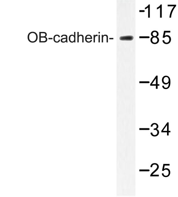 Western blot of OB-cadherin (K444) pAb in extracts from Jurkat cells.